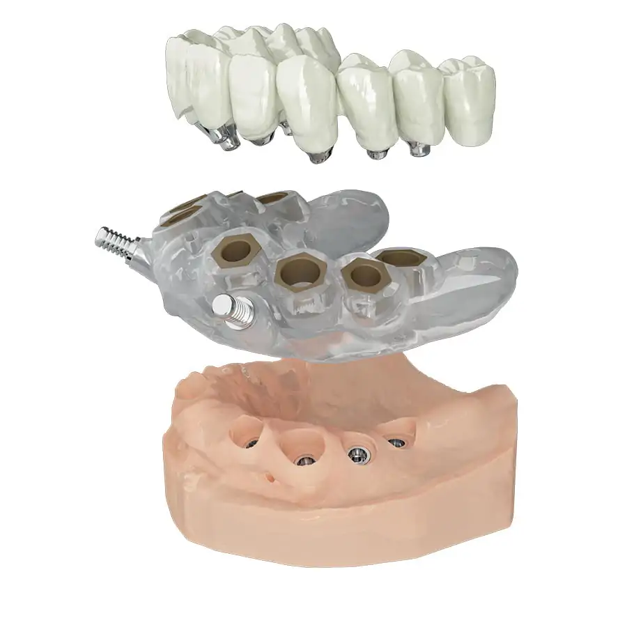 Chirurgia digitale - Chirurgia computer guidata