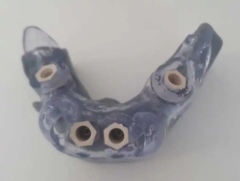 Implant Insertion With Enhanced Offset In Guided Surgery